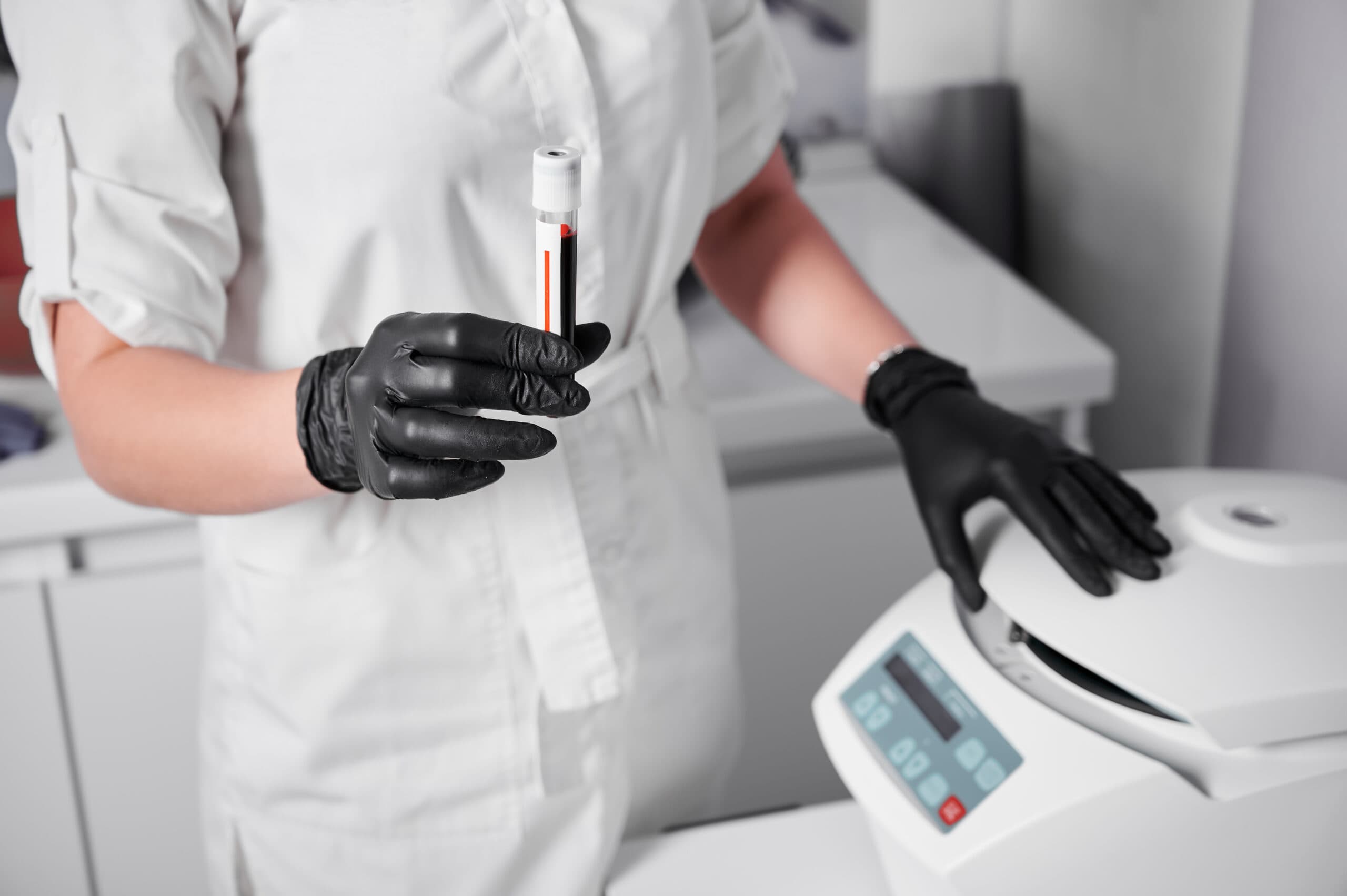 Plasma Rico en Plaquetas (PRP)